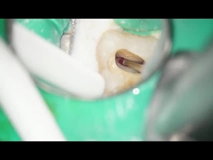 الأزيز RA الأسنان الأزيز التنغستن كربيد الأسنان استخدام سرعة منخفضة