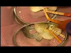 قضية المعالجة